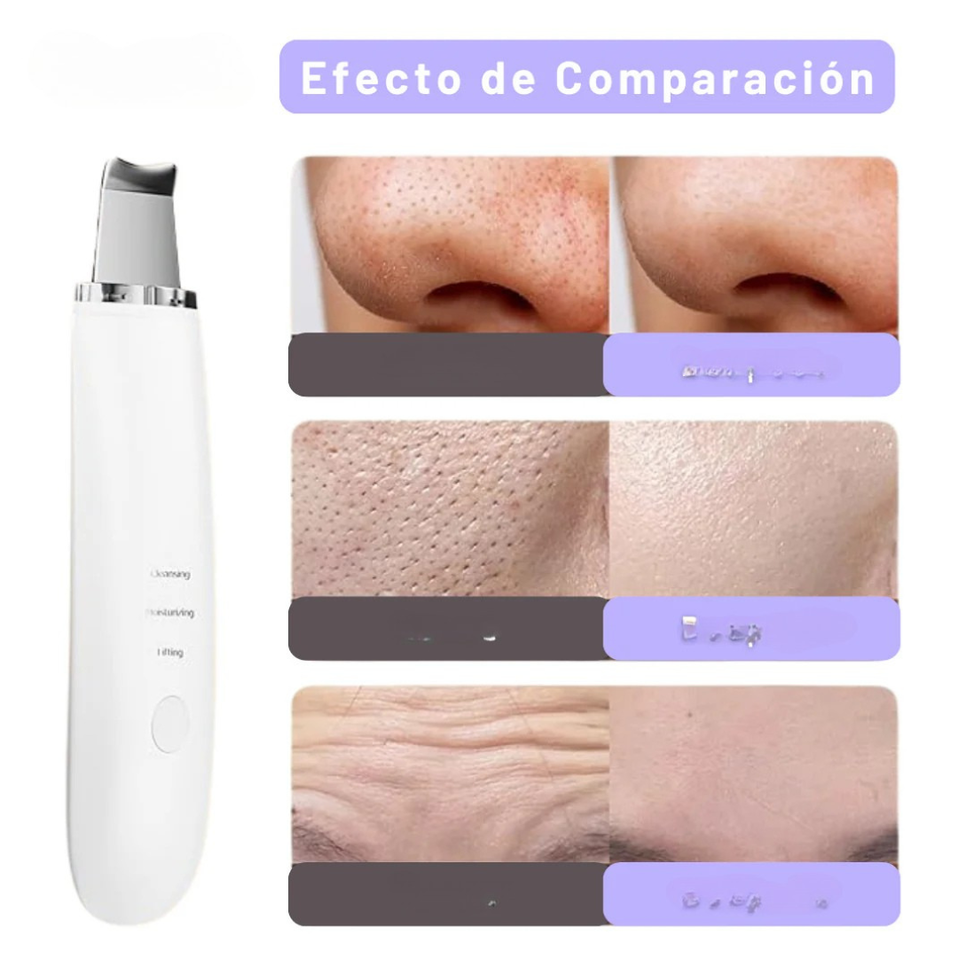 Limpiador Ultrasónico MultiPeel Power.