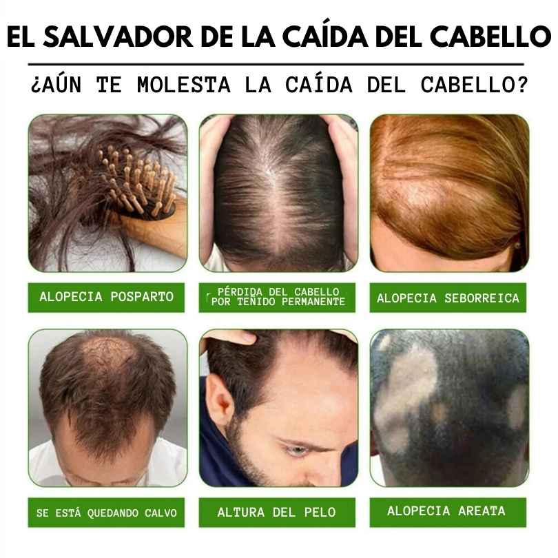 TONICO CAPILAR-TRATAMIENTO.